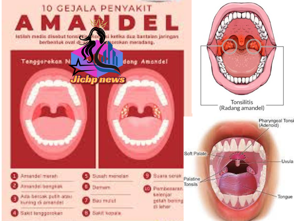 Amandel dan Dampaknya Penjelasan Lengkap-indotip1